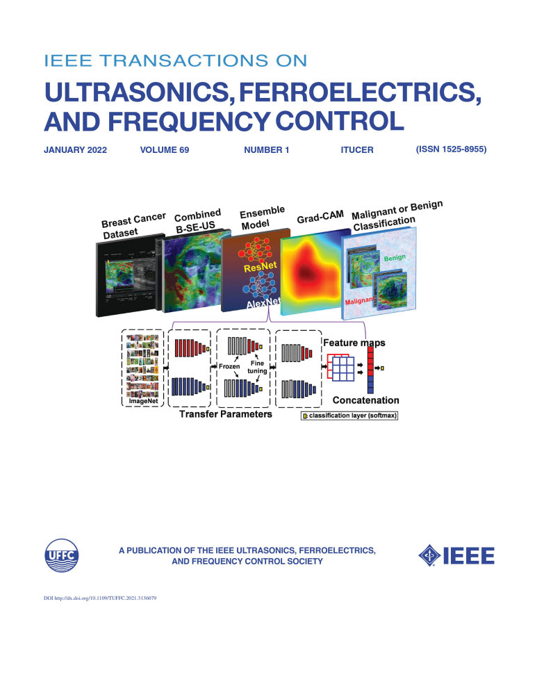 초음파 영상 분야 국제 학술지 IEEE Transactions on Ultrasonics, Ferroelectrics, and Frequency Control의 1월호에 실린 김철홍 교수의 연구논문 표지 그림.