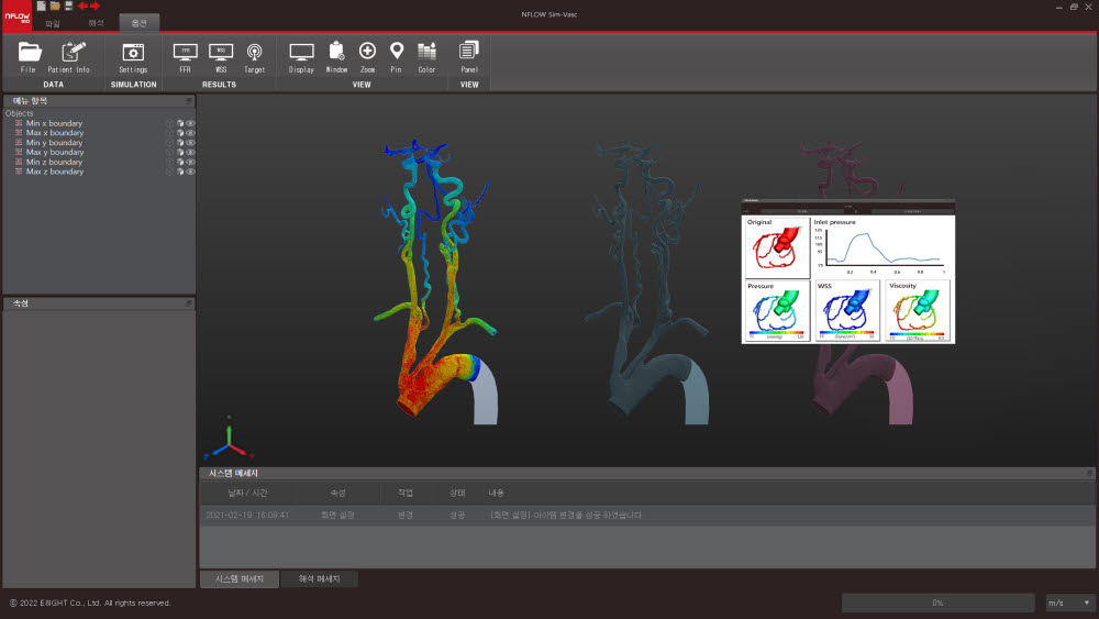 이에이트 엔플로우(NFLOW) 혈관 시뮬레이션 솔루션 (사진=이에이트)