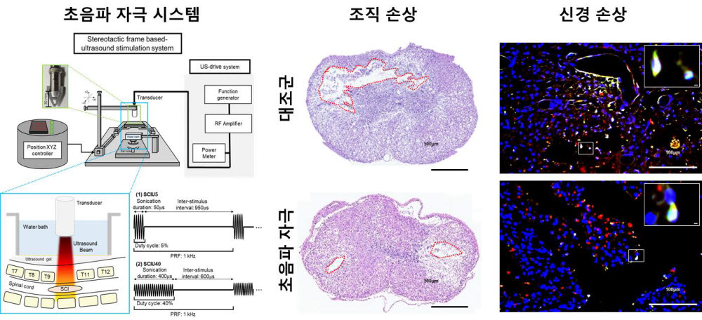 케이메디허브는 척수손상 동물모델을 이용해 초음파 치료효과를 검증했다. 외과수술밖에 치료법이 없던 척수손상 관련 초음파 치료 가능성이 열렸다. 초음파 치료 관련 이미지.