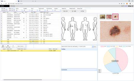 한국전자통신연구원(ETRI) 노인 피부질환 진단 인공지능 기술 분석 화면. 사진=ETRI