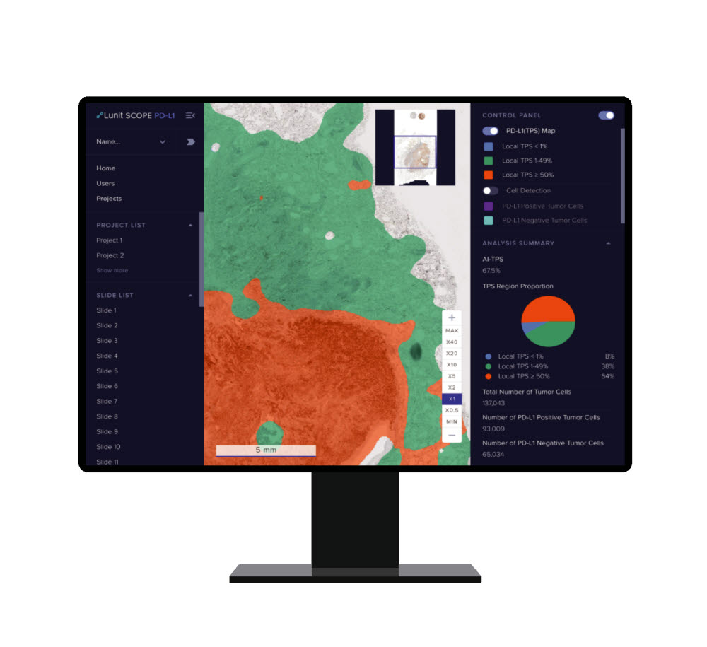 루닛이 AI 병리분석 솔루션 루닛 스코프 PD-L1 (사진=루닛)