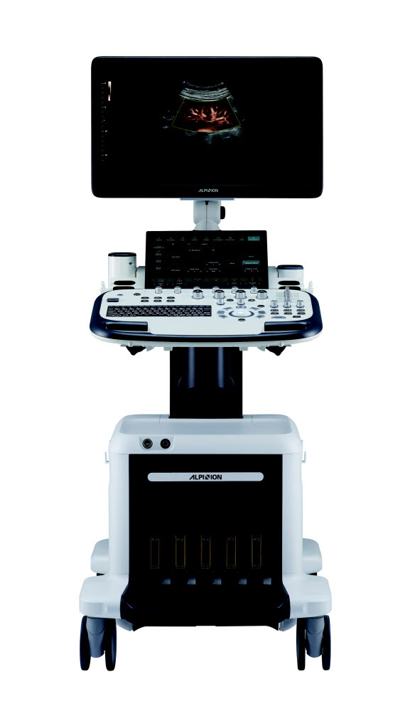 알피니언 초음파 진단기기 엑스큐브 90 (사진=일진그룹 알피니언)