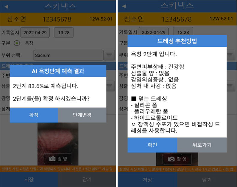 삼성서울병원이 파인헬스케어와 공동연구를 통해 개발한 인공지능 욕창 단계 예측 솔루션 스키넥스 (사진=삼성서울병원)