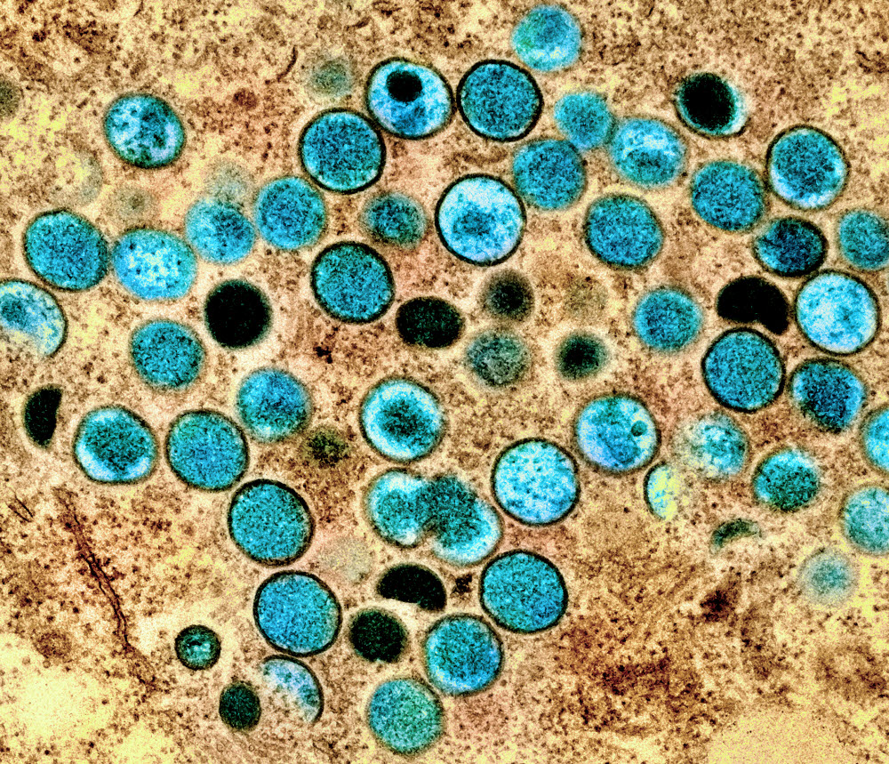 The appearance of monkey pox virus particles (blue) observed with an electron microscope.  (Source: NIAID)