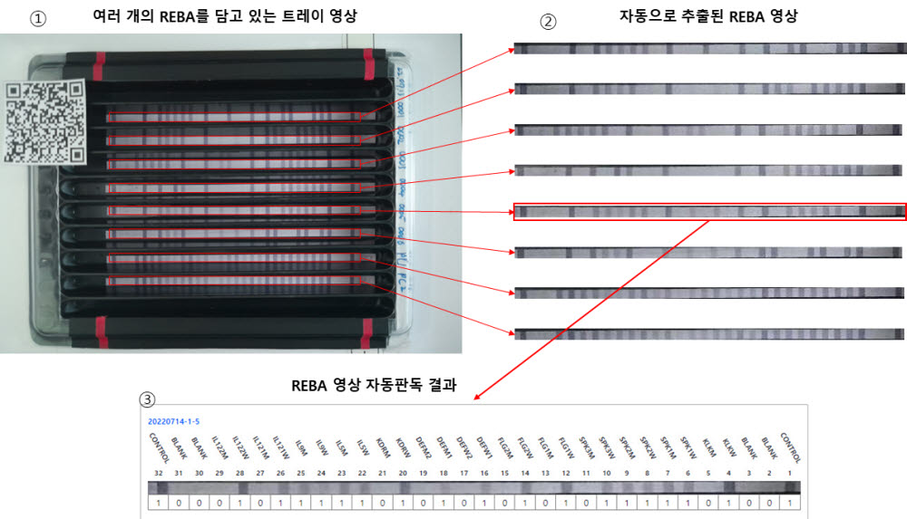 남영광 연세대학교 미래캠퍼스 소프트웨어학부 교수가 개발한 레바(REBA) 영상 자동 인식 플랫폼을 통한 자동 판독 사례