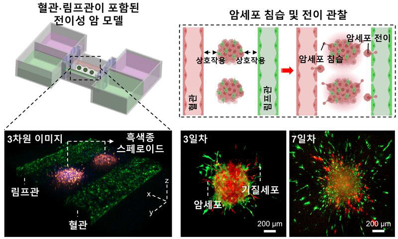 인-배스(In-bath) 3차원 바이오프린팅 기술을 통해 제작한 혈관·림프관이 포함된 체외 전이성 흑색종 모델. 개발된 모델에서 암세포의 침습과 전이 현상을 관찰할 수 있었다.