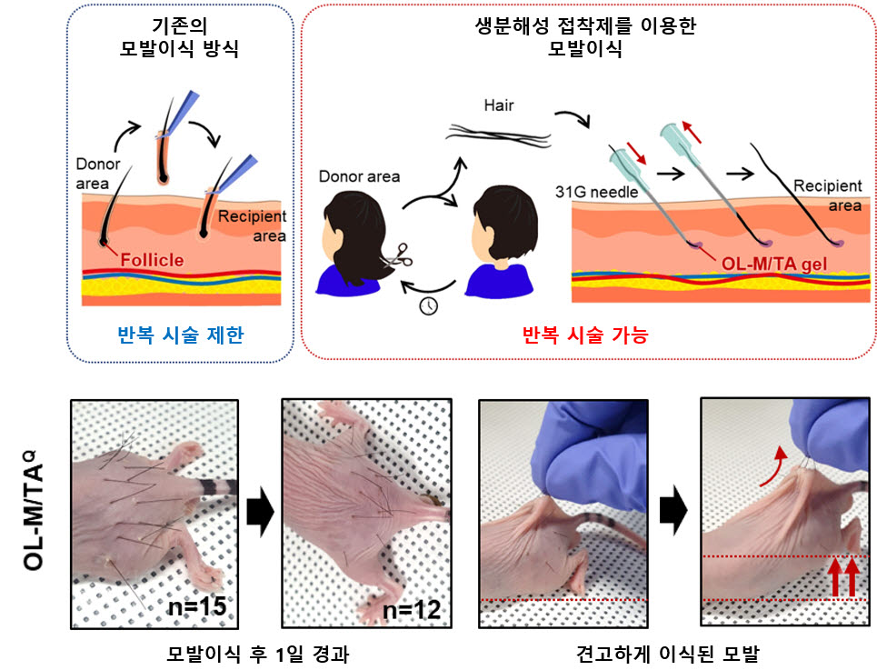 기존 모발이식 방식과 이번 KAIST 개발 방식 비교