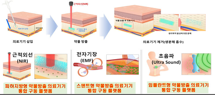 메카노바이오활성소재 혁신의료기기 활용 예시.