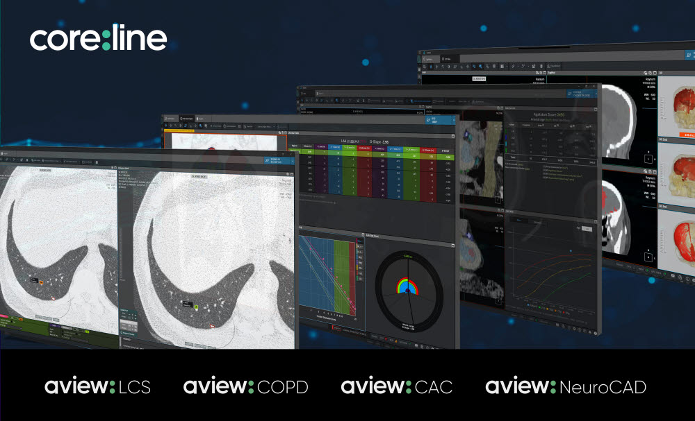 코어라인소프트의 의료 AI 솔루션 이미지.