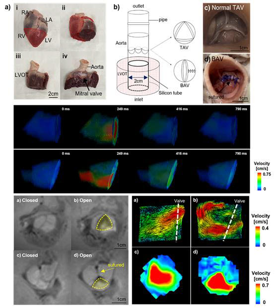 권민성 학생연구원이 허형규 케이메디허브 선임연구원과 함께 개발한 심장판막질환 모델 및 혈류가시화 결과
