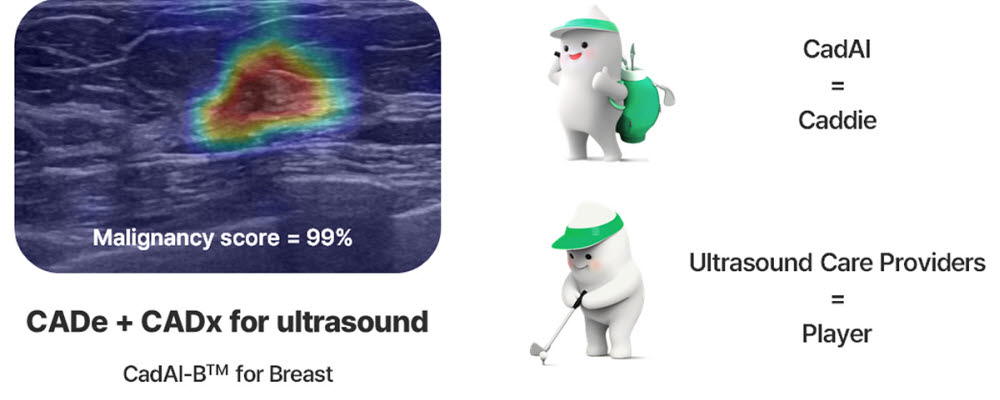 빔웍스의 초음파 유방암 실시간 AI 진단 시스템 캐디-B