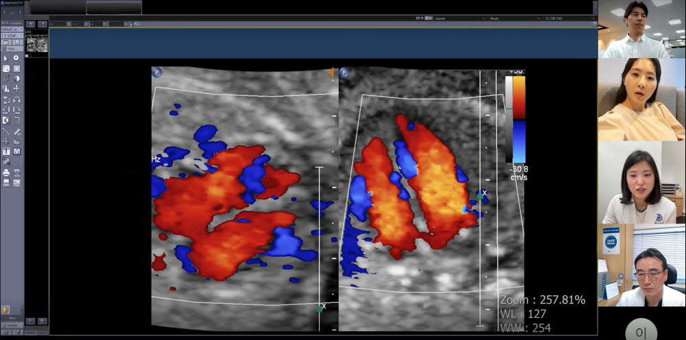 보호자와 산모, 2차 의료기관(미즈메디병원 전진동 진료부장), 세브란스병원(권하얀 산부인과 교수) 주치의가 산모의 초음파 검사 결과를 함께 보며 협진을 하는 모습. (사진제공=세브란스병원)