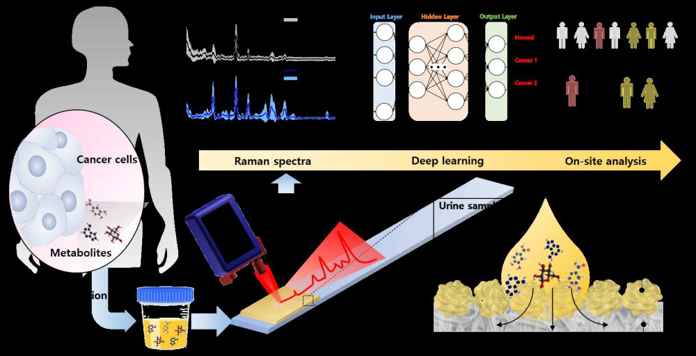 소변 내 대사체 광신호 증폭과 스트립형 소변 센서를 이용한 암 진단 모식도.