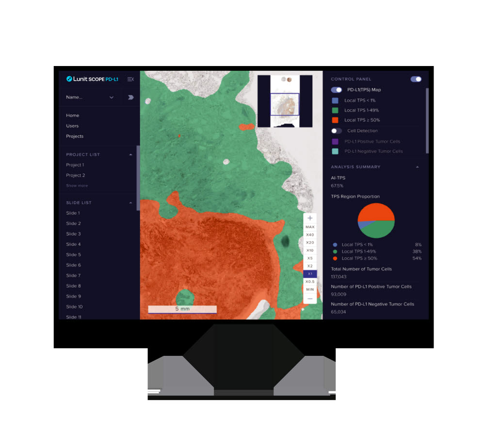 루닛 AI 기반 병리분석 솔루션 루닛 스코프 PD-L1 (루닛 제공)