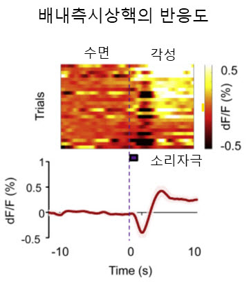 소리자극에 반응하는 배내측 신경