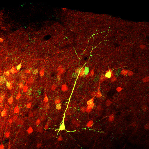 ST-Cal-Light를 이용하여 표지된 운동학습시 활성화되는신경세포들 (노란색)