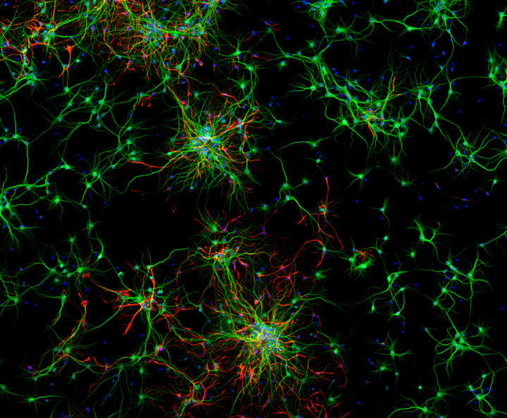 ST-Cal-Light이 발현된 배양된 신경세포들